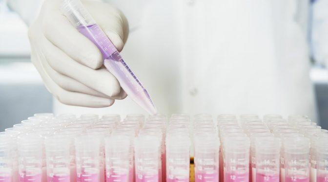 A Low Sperm Count is the Most Common Fertility Problem for Men
